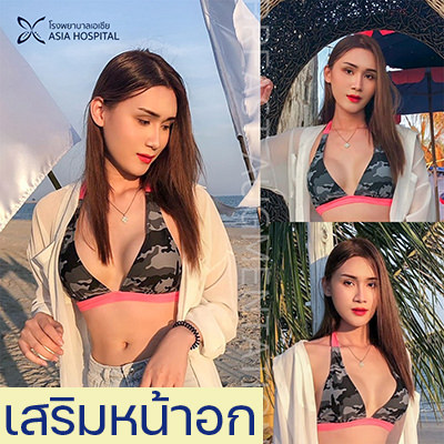 เสริมหน้าอก-ทำนมที่ไหนดี